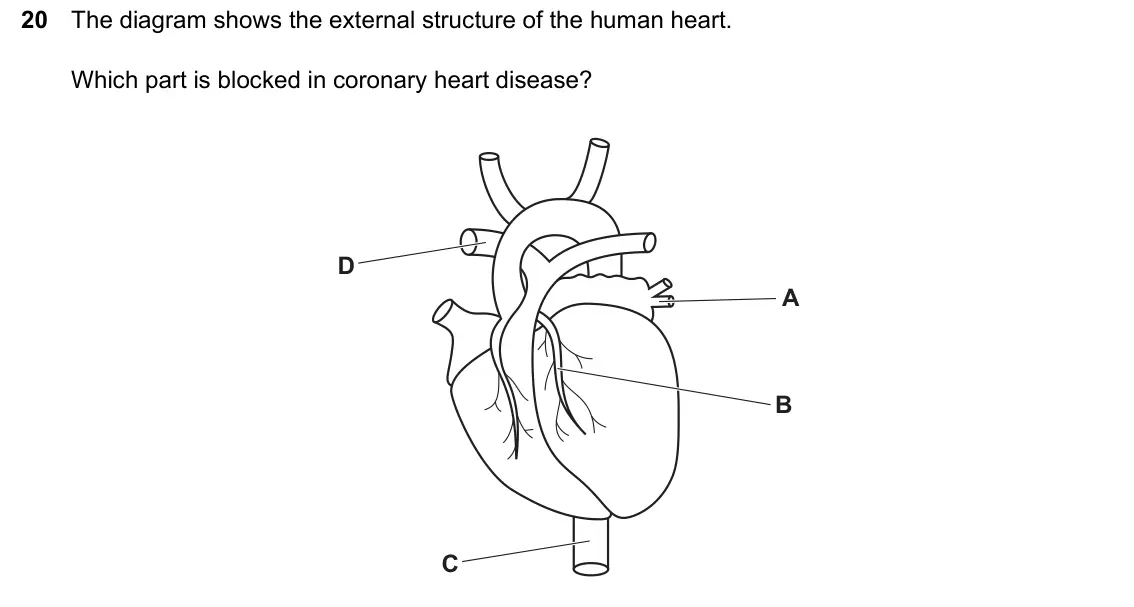 June 2024 Paper 2, question 20: The diagram shows the external structure of the human heart. Which part is blocked in coronary heart disease? D A B C