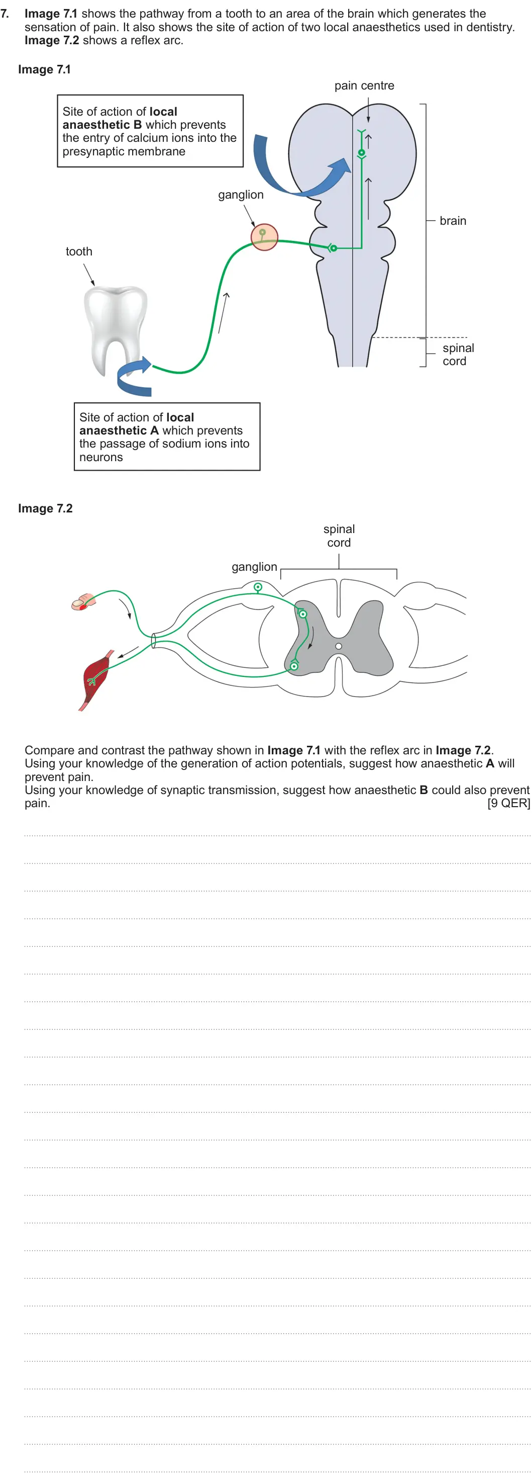 Summer 2023 Unit 3, question 7: Image 7.1 shows the pathway from a tooth to an area of the brain which generates the sensation of pain. It also shows the site of action of two local anaestheti