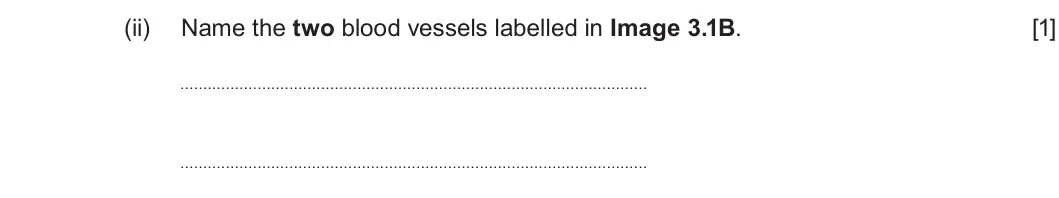 Summer 2025 Unit 3, question 3(a)(ii): Name the two blood vessels labelled in Image 3.1B. [1]