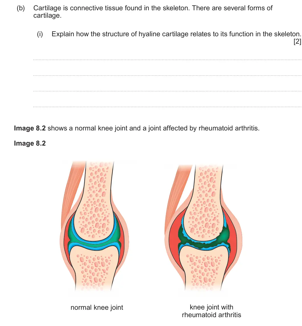 Summer 2024 Unit 4, question 8(b)(i): Explain how the structure of hyaline cartilage relates to its function in the skeleton. [2] Image 8.2 shows a normal knee joint and a joint affected by rheumato