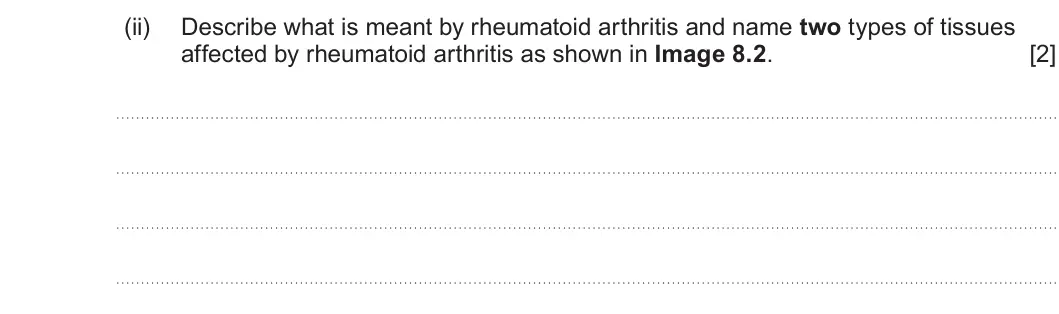 Summer 2024 Unit 4, question 8(b)(ii): Describe what is meant by rheumatoid arthritis and name two types of tissues affected by rheumatoid arthritis as shown in Image 8.2. [2]
