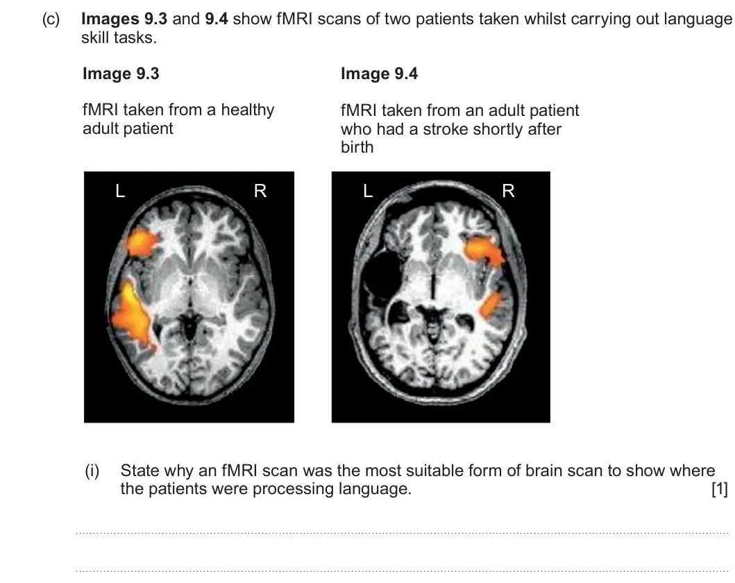Summer 2024 Unit 4, question 9(c)(i): State why an fMRI scan was the most suitable form of brain scan to show where the patients were processing language. [1]