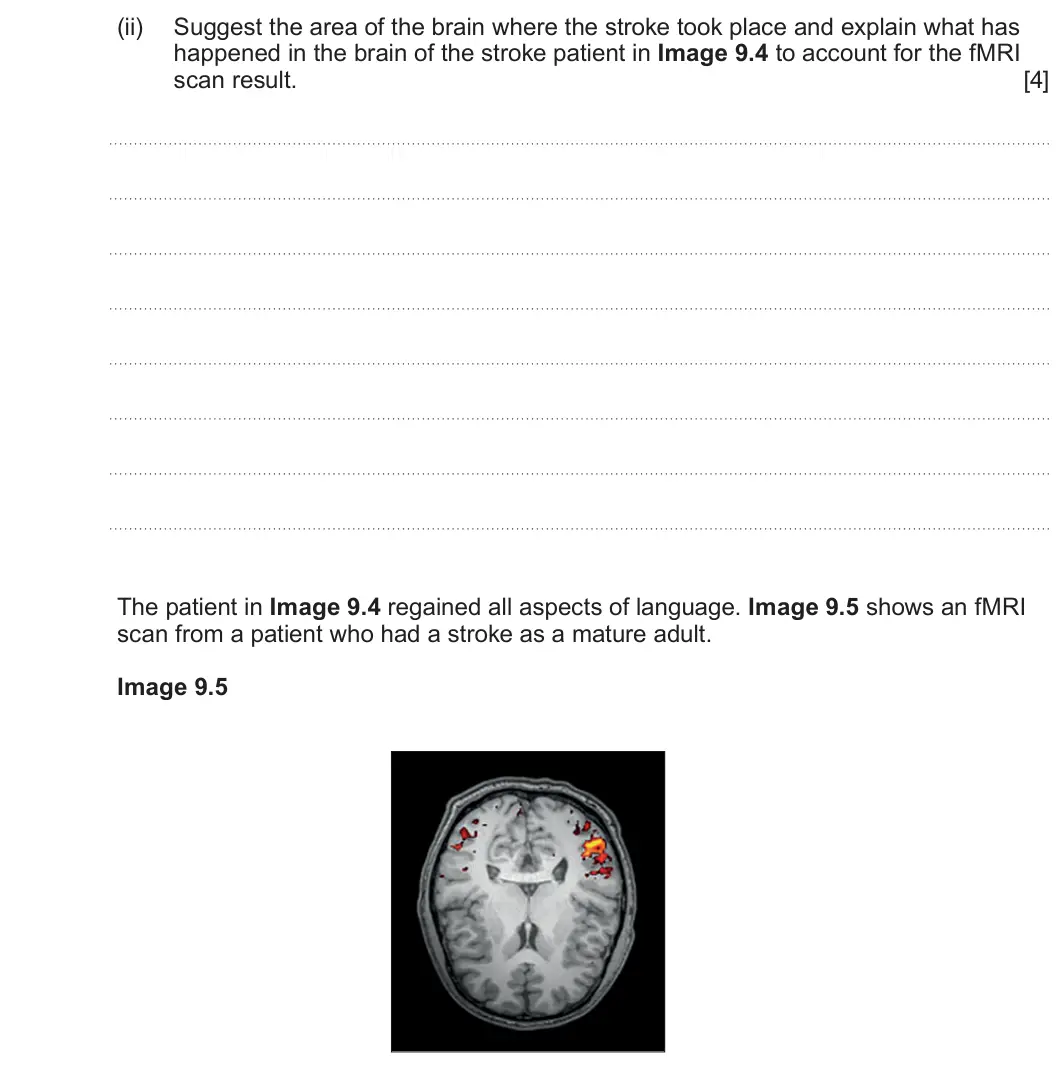 Summer 2024 Unit 4, question 9(c)(ii): Suggest the area of the brain where the stroke took place and explain what has happened in the brain of the stroke patient in Image 9.4 to account for the fMRI