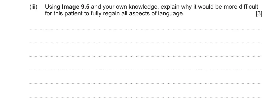 Summer 2024 Unit 4, question 9(c)(iii): Using Image 9.5 and your own knowledge, explain why it would be more difficult for this patient to fully regain all aspects of language. [3]