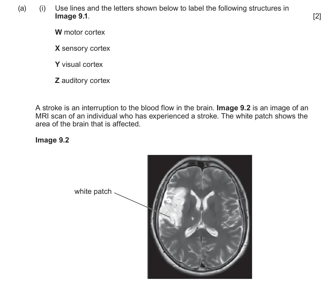 Summer 2025 Unit 4, question 9(a)(i): Use lines and the letters shown below to label the following structures in Image 9.1. [2] W motor cortex X sensory cortex Y visual cortex Z auditory cortex A st