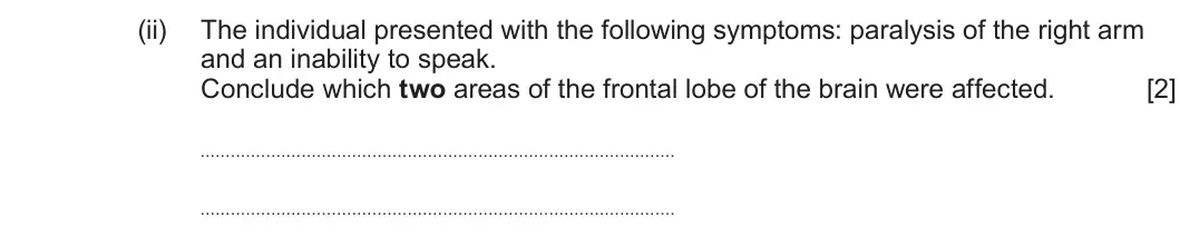 Summer 2025 Unit 4, question 9(a)(ii): The individual presented with the following symptoms: paralysis of the right arm and an inability to speak. Conclude which two areas of the frontal lobe of the