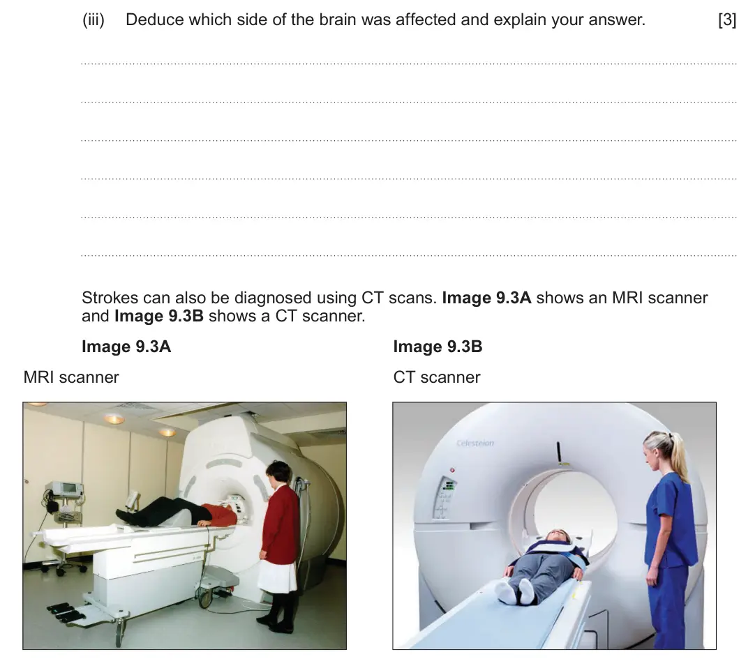 Summer 2025 Unit 4, question 9(a)(iii): Deduce which side of the brain was affected and explain your answer. [3] Strokes can also be diagnosed using CT scans. Image 9.3A shows an MRI scanner and Image