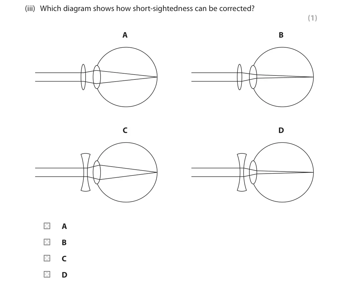 June 2023 Paper 1 Higher, question 4(a)(iii): Which diagram shows how short-sightedness can be corrected? (1) A B C D A B C D