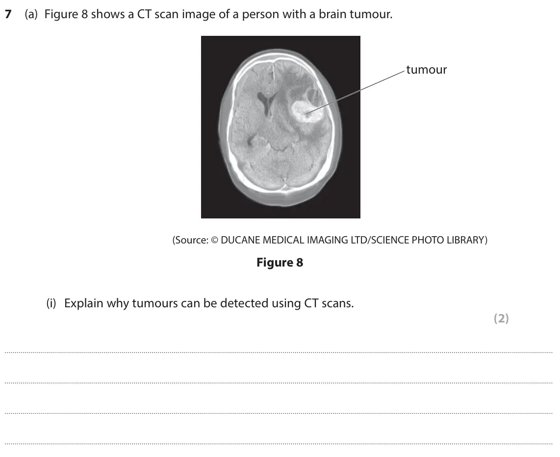 June 2025 Paper 1 Higher, question 7(a)(i): Explain why tumours can be detected using CT scans. (2)