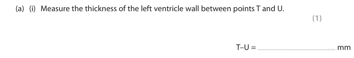 June 2025 Paper 2 Foundation, question 6(a)(i): Measure the thickness of the left ventricle wall between points T and U. (1) T–U = mm
