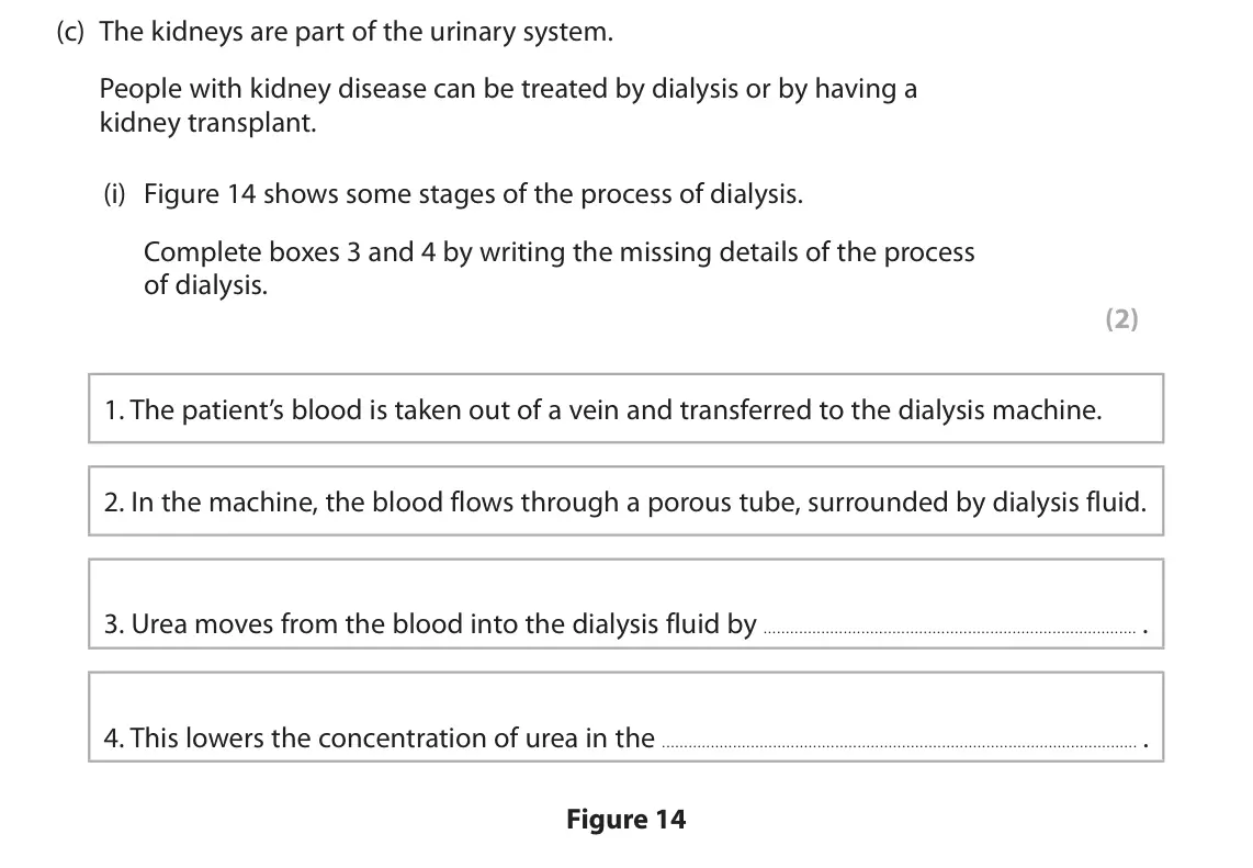 June 2025 Paper 2 Foundation, question 7(c)(i): Figure 14 shows some stages of the process of dialysis. Complete boxes 3 and 4 by writing the missing details of the process of dialysis. (2) 1. The patient’s b