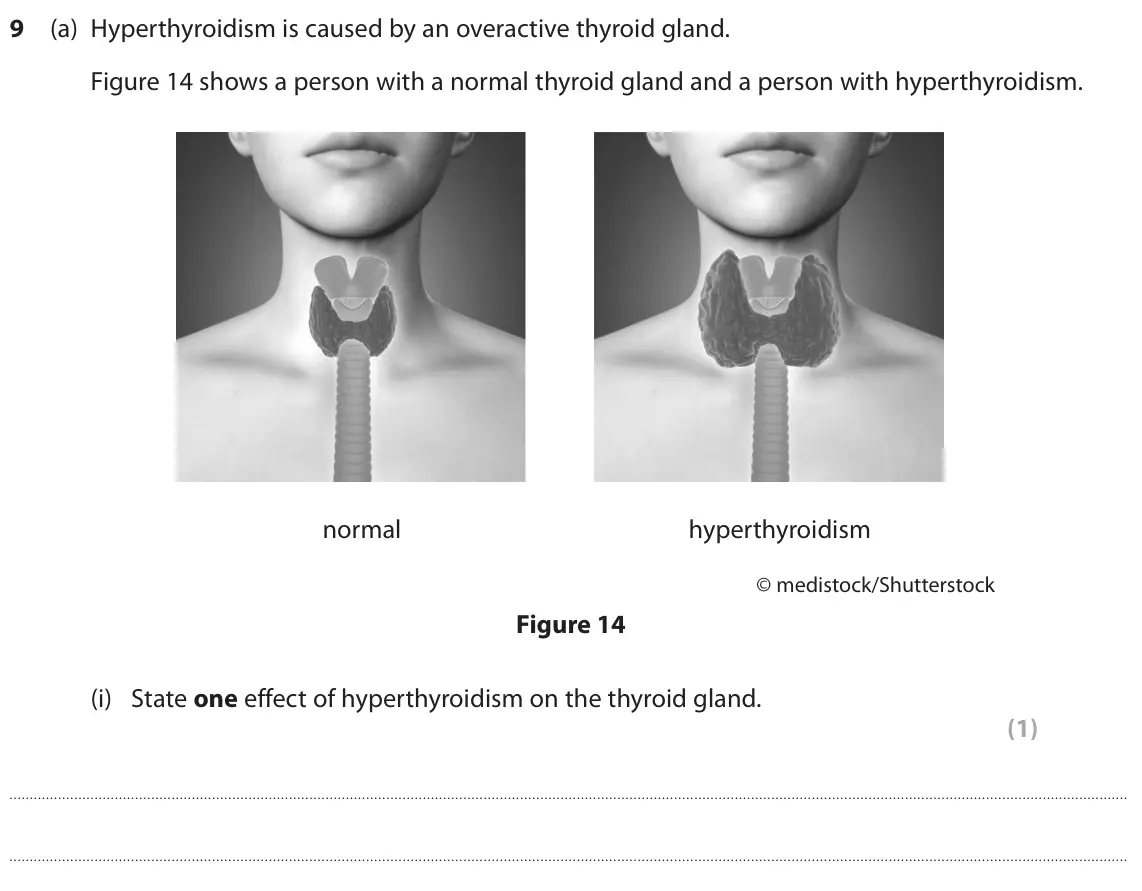 November 2020 Paper 2 Higher, question 9(a)(i): State one effect of hyperthyroidism on the thyroid gland. (1)