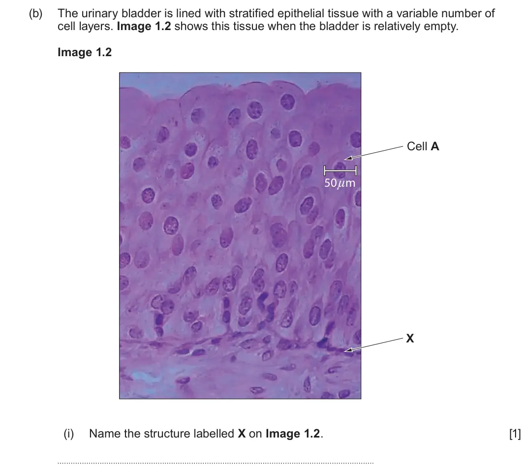 Summer 2022 AS Unit 1, question 1(b)(i): Name the structure labelled X on Image 1.2. [1]