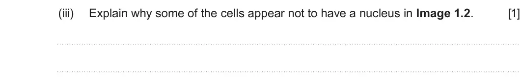 Summer 2022 AS Unit 1, question 1(b)(iii): Explain why some of the cells appear not to have a nucleus in Image 1.2. [1]