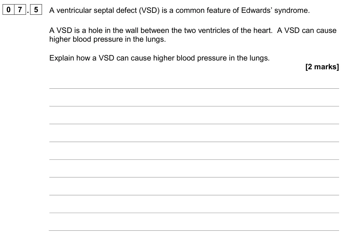 June 2024 AS Paper 2, question 07.5: A ventricular septal defect (VSD) is a common feature of Edwards’ syndrome. A VSD is a hole in the wall between the two ventricles of the heart. A VSD can cause
