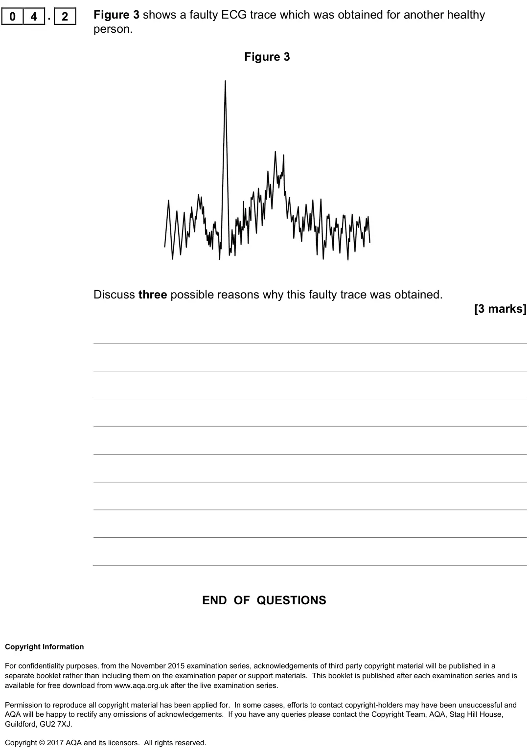June 2017 Paper 3 Medical physics, question 04.2: Figure 3 shows a faulty ECG trace which was obtained for another healthy person. Figure 3 Discuss three possible reasons why this faulty trace was obtained. [3