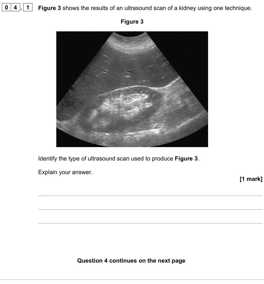 June 2023 Paper 3 Medical physics, question 04.1: Figure 3 shows the results of an ultrasound scan of a kidney using one technique. Figure 3 Identify the type of ultrasound scan used to produce Figure 3. Explai