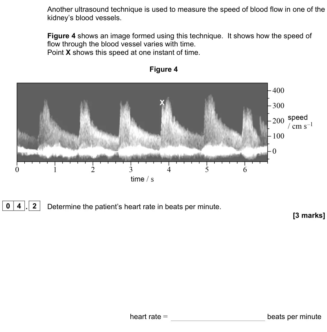 June 2023 Paper 3 Medical physics, question 04.2: Determine the patient’s heart rate in beats per minute. [3 marks] heart rate = beats per minute