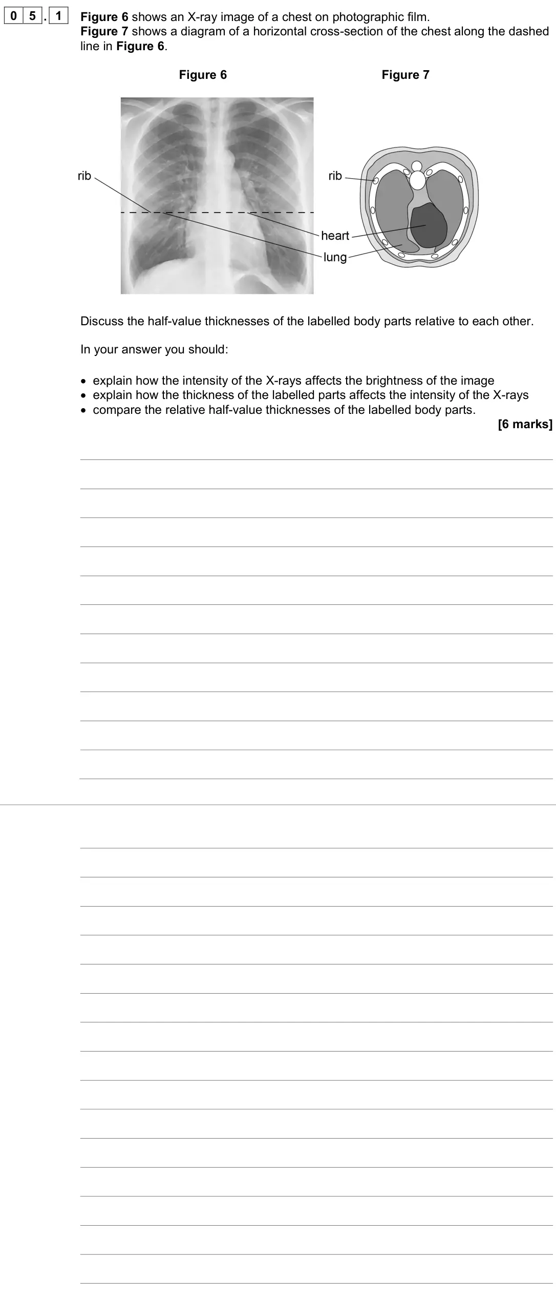 June 2023 Paper 3 Medical physics, question 05.1: Figure 6 shows an X-ray image of a chest on photographic film. Figure 7 shows a diagram of a horizontal cross-section of the chest along the dashed line in Figu