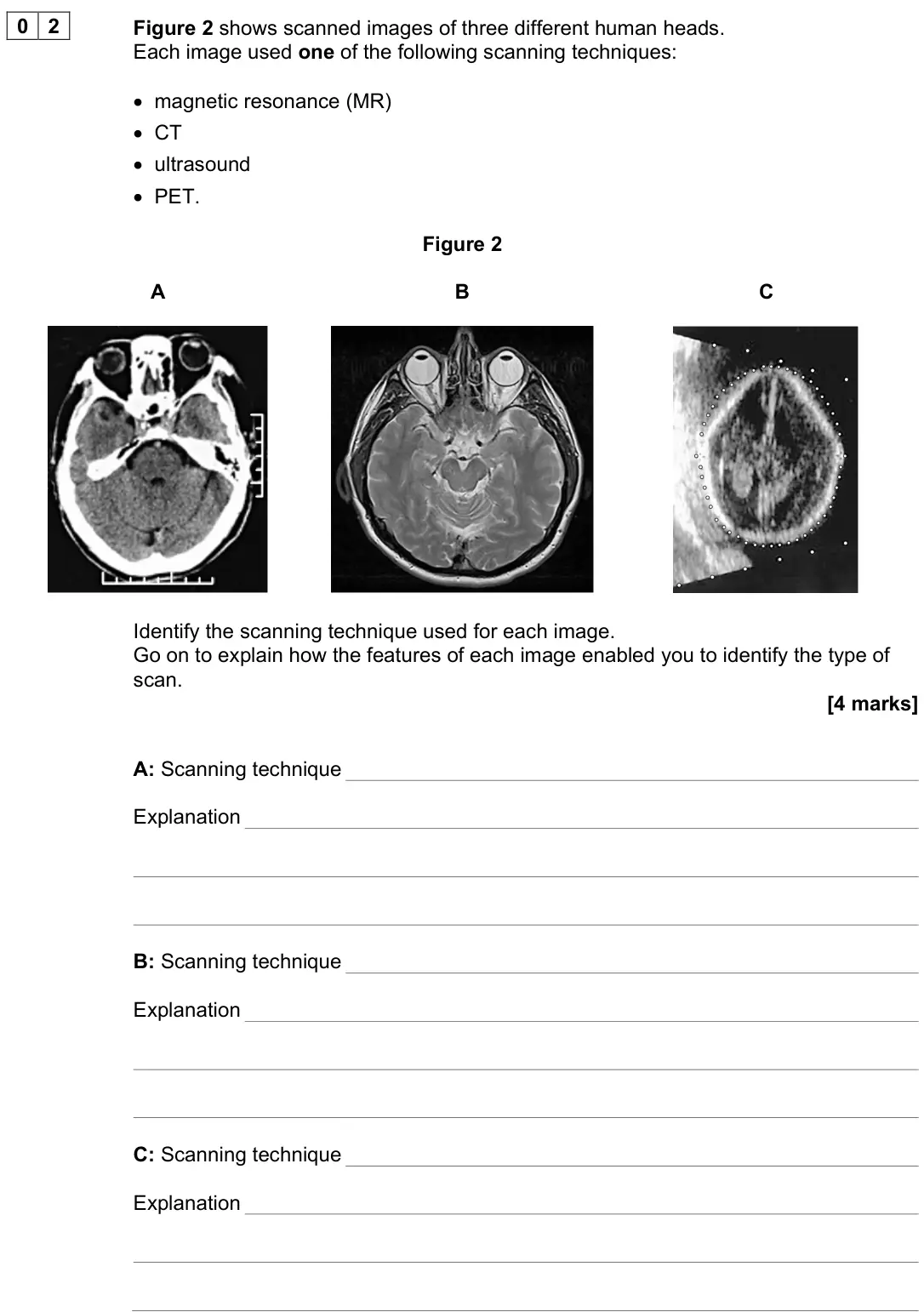 November 2021 Paper 3 Medical physics, question 02: Figure 2 shows scanned images of three different human heads. Each image used one of the following scanning techniques: • magnetic resonance (MR) • CT • ultraso