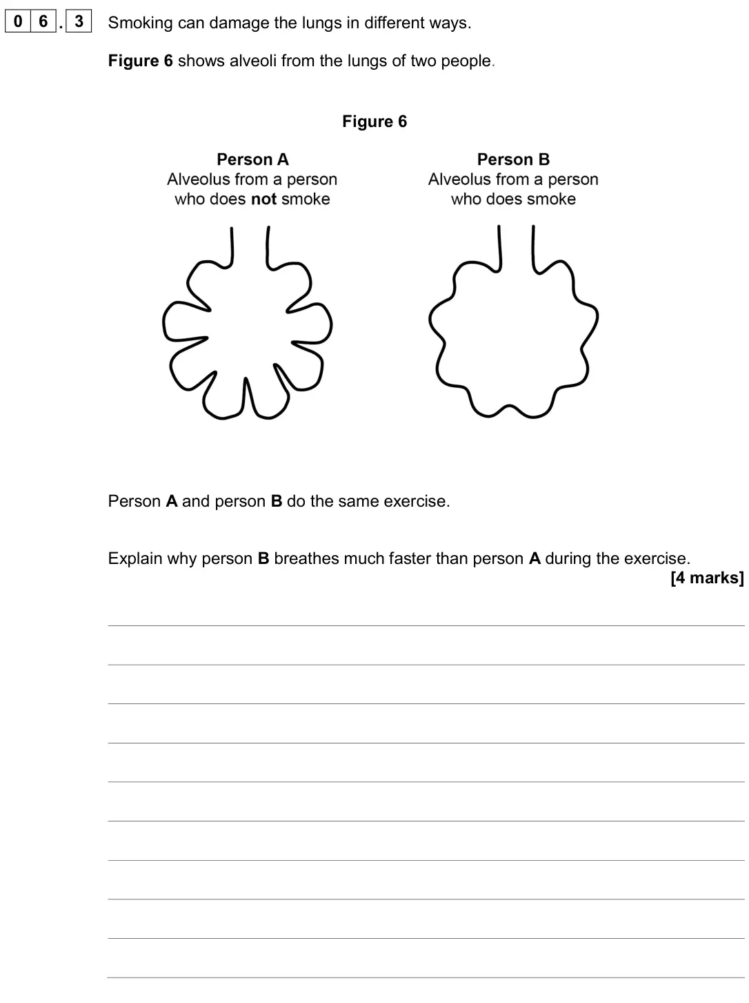 June 2024 Biology Paper 1 Higher, question 06.3: Smoking can damage the lungs in different ways. Figure 6 shows alveoli from the lungs of two people. Figure 6 Person A and person B do the same exercise. Explai