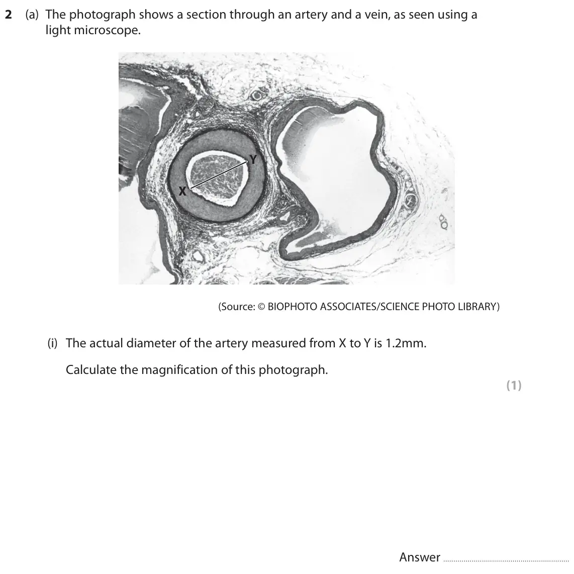 June 2025 AS Paper 2, question 2(a)(i): The actual diameter of the artery measured from X to Y is 1.2mm. Calculate the magnification of this photograph. (1) Answer