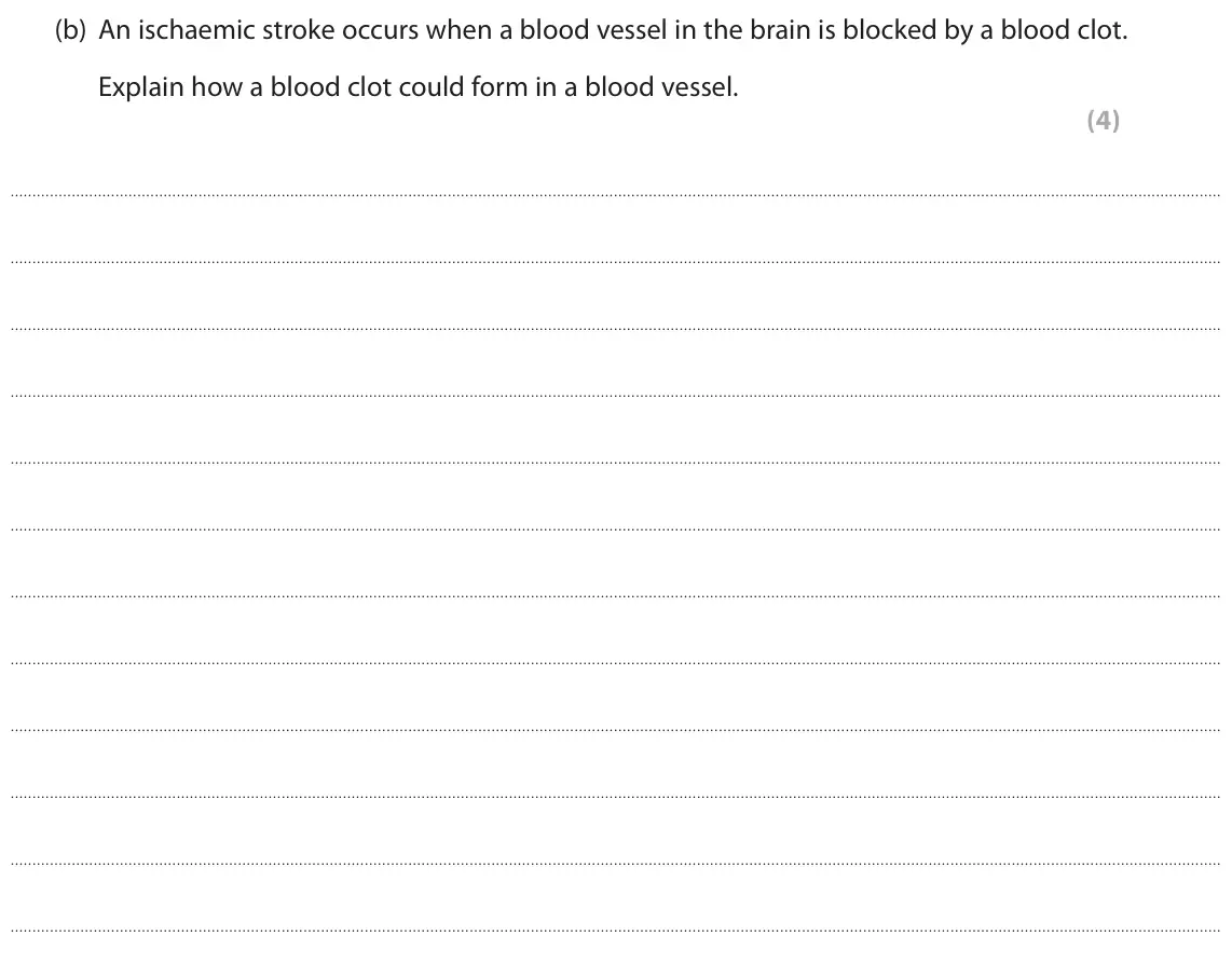 June 2019 AS Paper 1, question 8(b): An ischaemic stroke occurs when a blood vessel in the brain is blocked by a blood clot. Explain how a blood clot could form in a blood vessel. (4)
