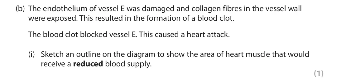 June 2023 AS Paper 1, question 5(b)(i): Sketch an outline on the diagram to show the area of heart muscle that would receive a reduced blood supply. (1)