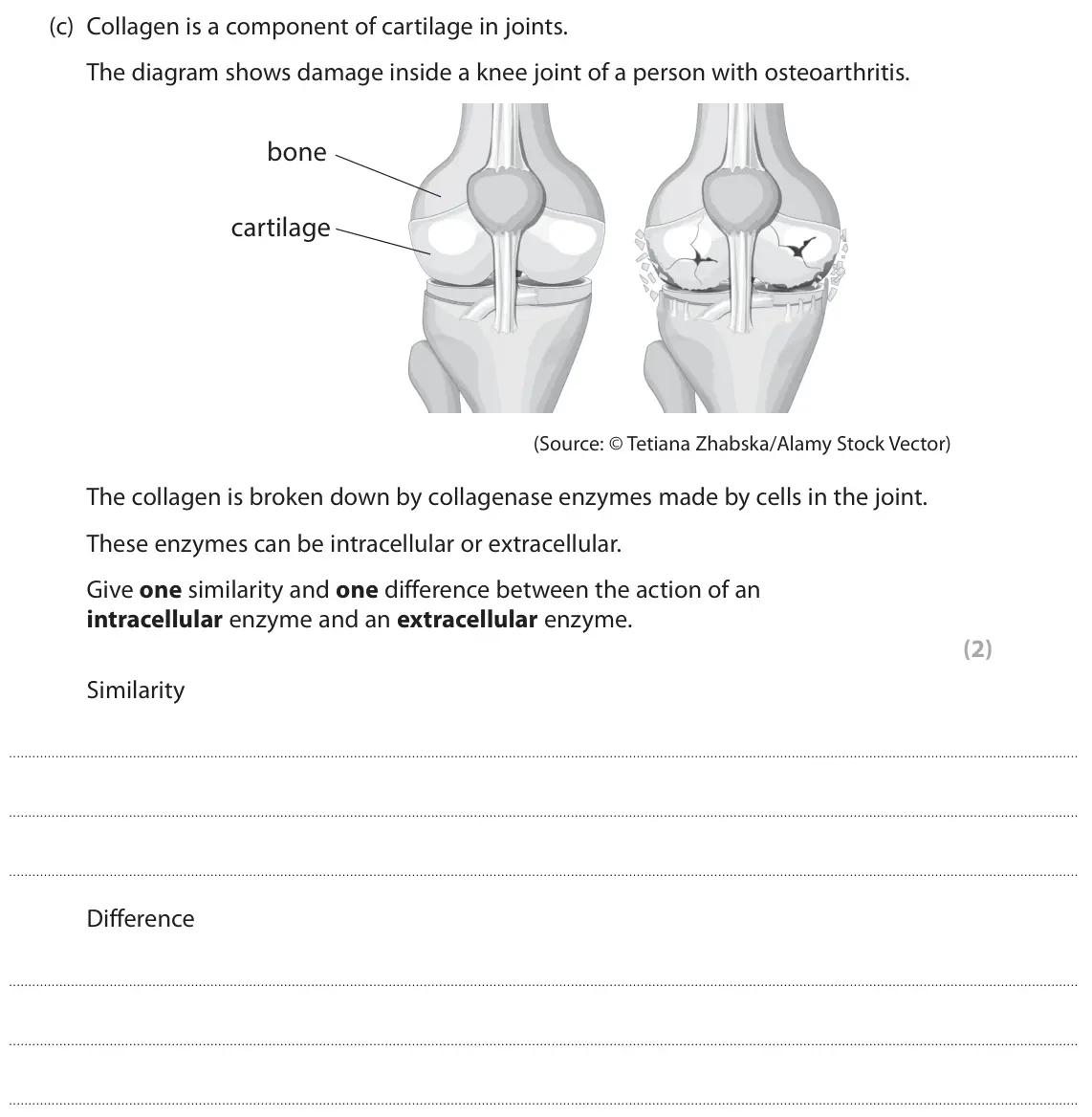 June 2025 AS Paper 1, question 6(c): Collagen is a component of cartilage in joints. The diagram shows damage inside a knee joint of a person with osteoarthritis. bone cartilage (Source: © Tetiana 