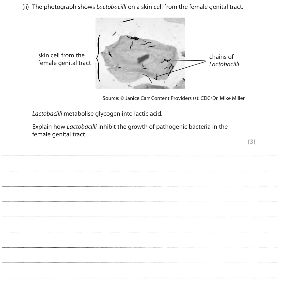 October 2020 Paper 1, question 8(a)(ii): The photograph shows Lactobacilli on a skin cell from the female genital tract. { skin cell from the chains of female genital tract Lactobacilli Source: © Janic