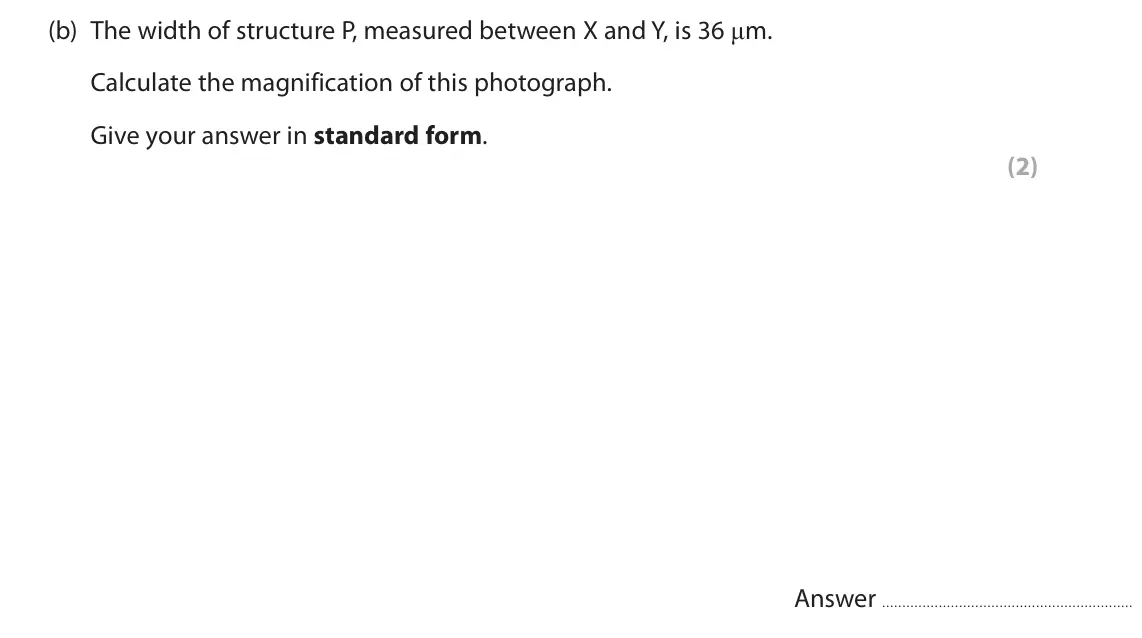 June 2024 Paper 2, question 1(b): The width of structure P, measured between X and Y, is 36 μm. Calculate the magnification of this photograph. Give your answer in standard form. (2) Answer