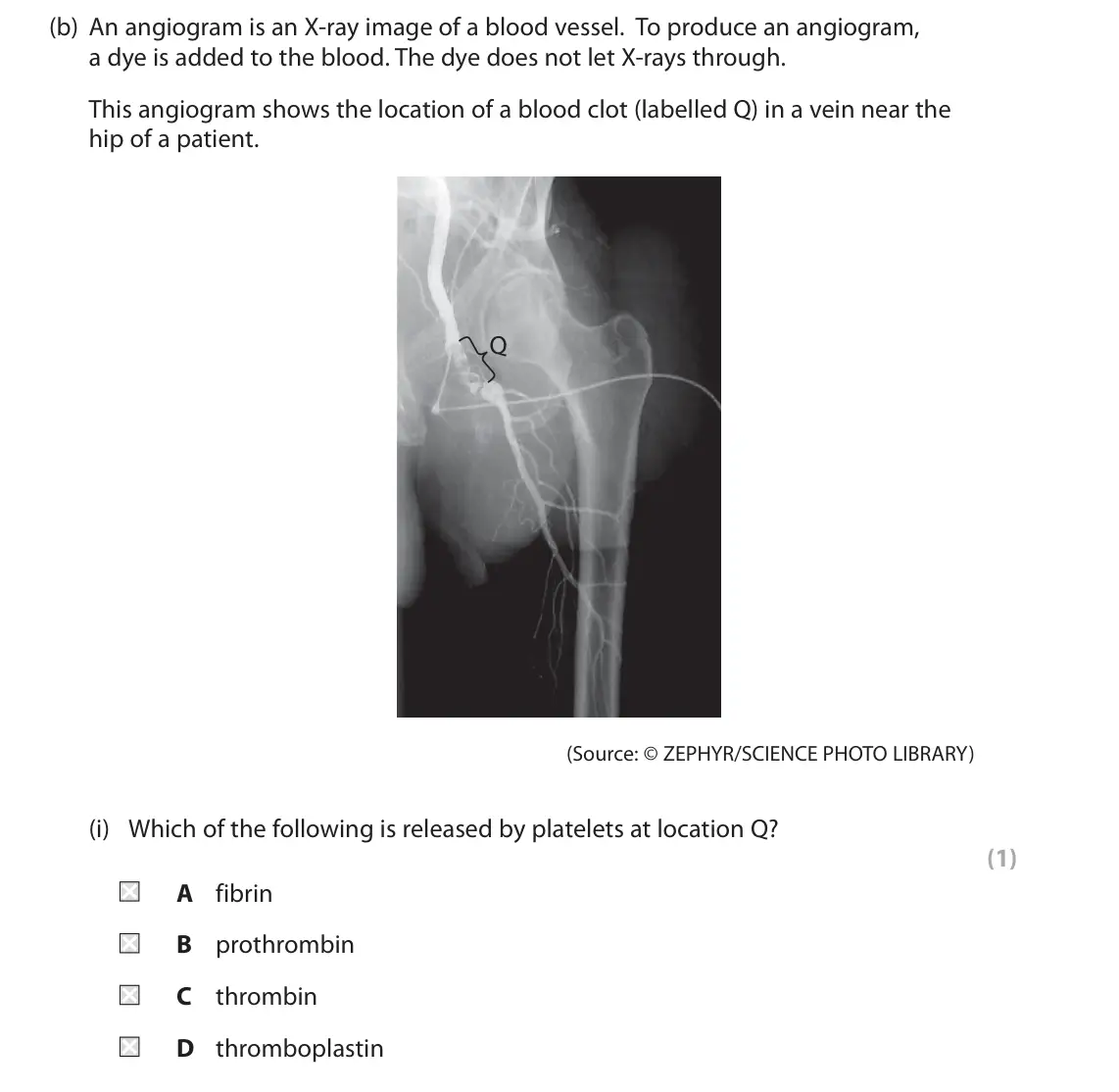 June 2022 Paper 2, question 1(b)(i): Which of the following is released by platelets at location Q? (1) A fibrin B prothrombin C thrombin D thromboplastin