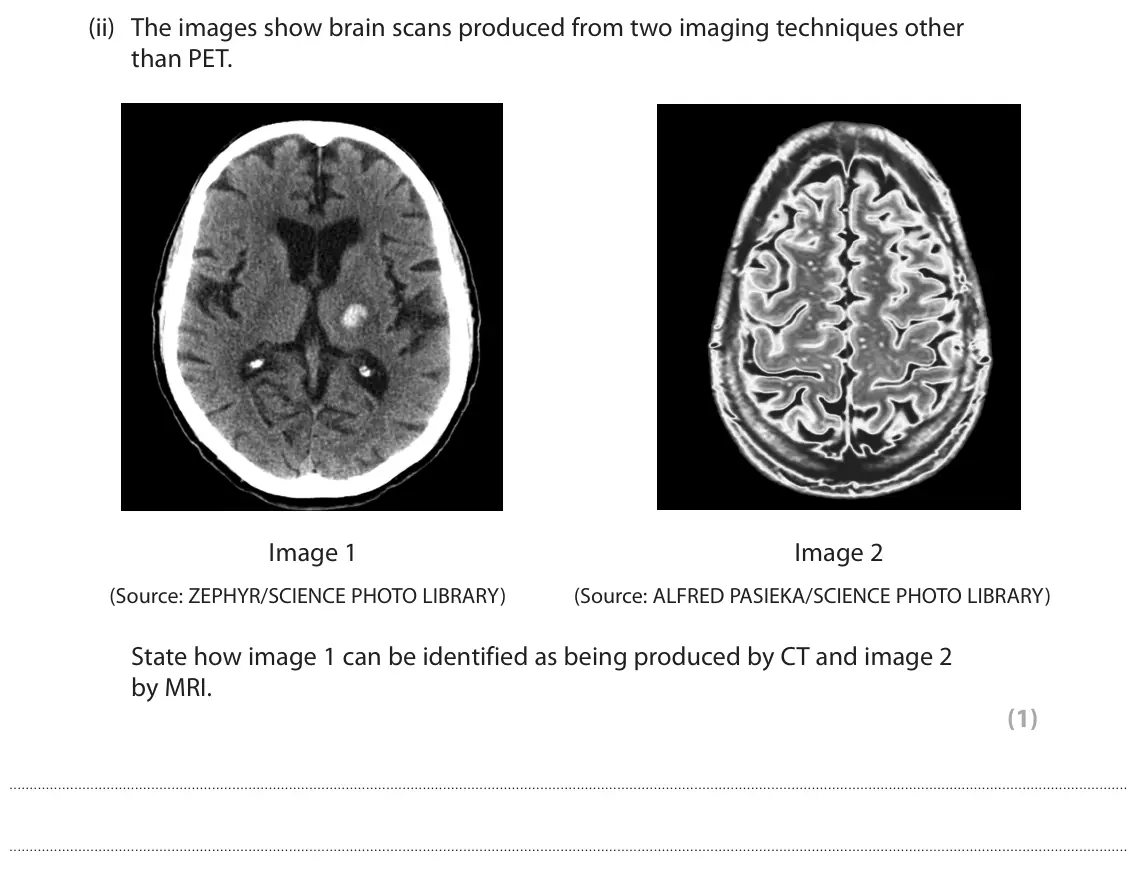 June 2024 Paper 2, question 1(b)(ii): The images show brain scans produced from two imaging techniques other than PET. Image 1 Image 2 (Source: ZEPHYR/SCIENCE PHOTO LIBRARY) (Source: ALFRED PASIEKA/