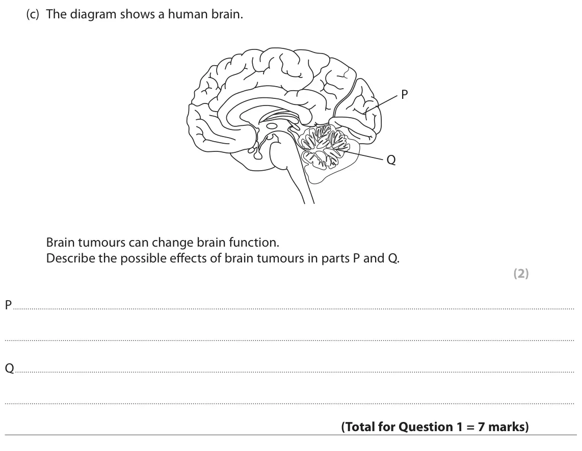 June 2024 Paper 2, question 1(c): The diagram shows a human brain. P Q Brain tumours can change brain function. Describe the possible effects of brain tumours in parts P and Q. (2) P Q