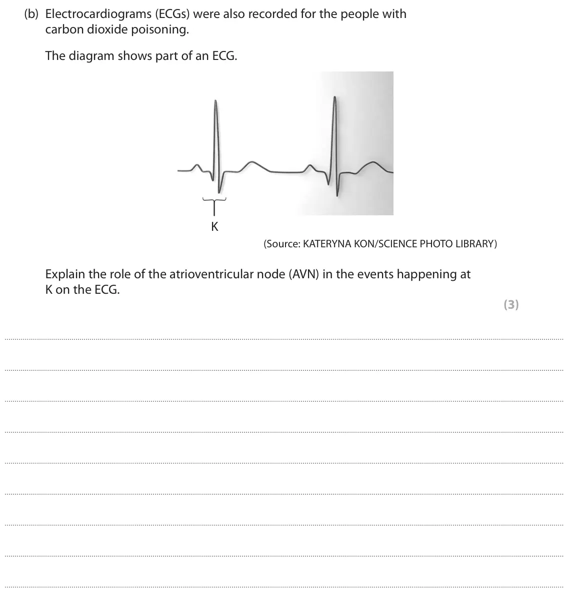 June 2024 Paper 2, question 3(b): Electrocardiograms (ECGs) were also recorded for the people with carbon dioxide poisoning. The diagram shows part of an ECG. K (Source: KATERYNA KON/SCIENCE PHO
