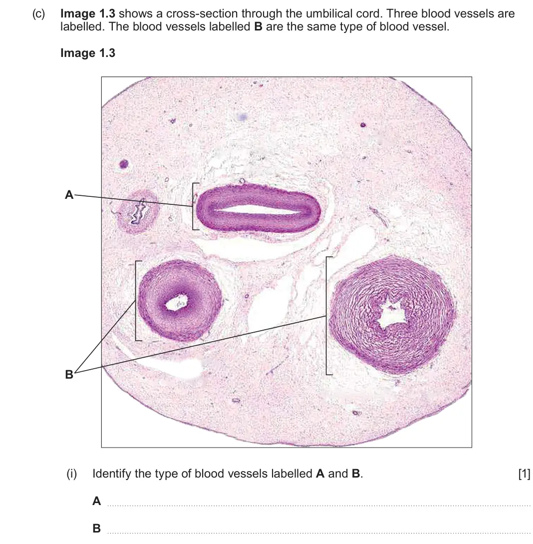 June 2024 Component 2, question 1(c)(i): Identify the type of blood vessels labelled A and B. [1] A  B 