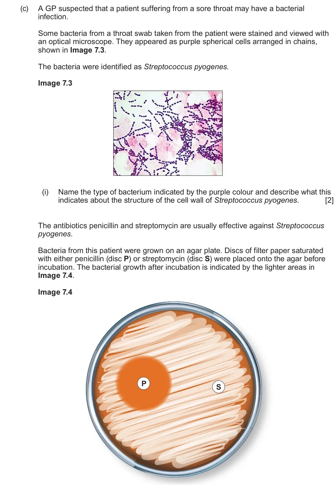 June 2022 Component 3, question 7(c)(i): Name the type of bacterium indicated by the purple colour and describe what this indicates about the structure of the cell wall of Streptococcus pyogenes. [2] T