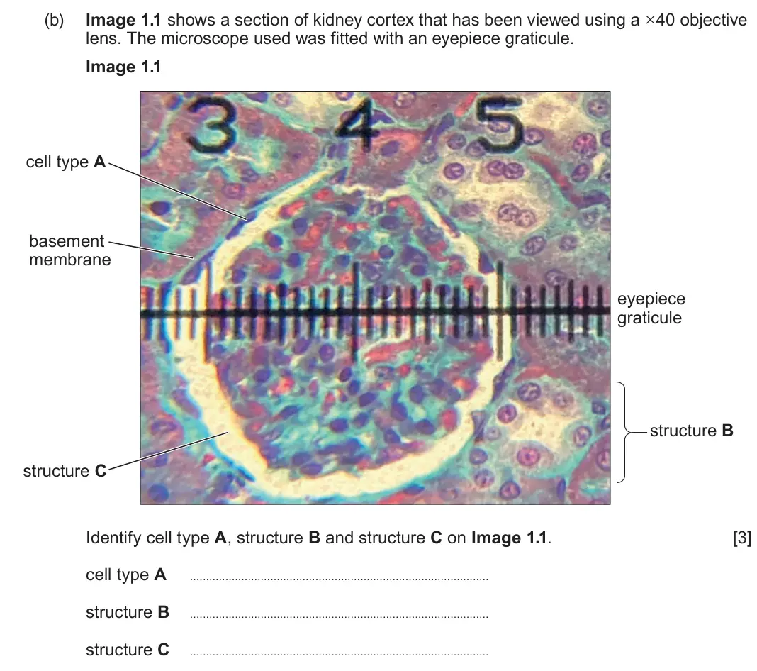 June 2023 Component 3, question 1(b): Image 1.1 shows a section of kidney cortex that has been viewed using a ×40 objective lens. The microscope used was fitted with an eyepiece graticule. Image 1.1