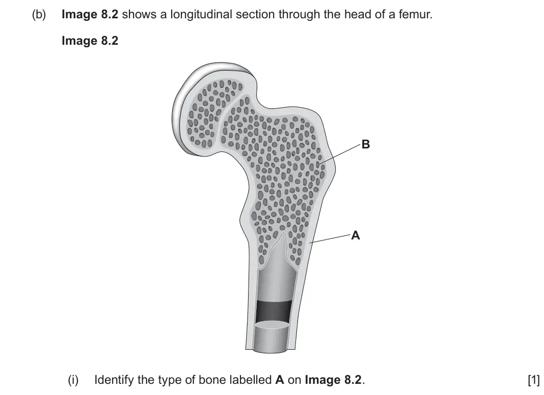 June 2024 Component 3, question 8(b)(i): Identify the type of bone labelled A on Image 8.2. [1]