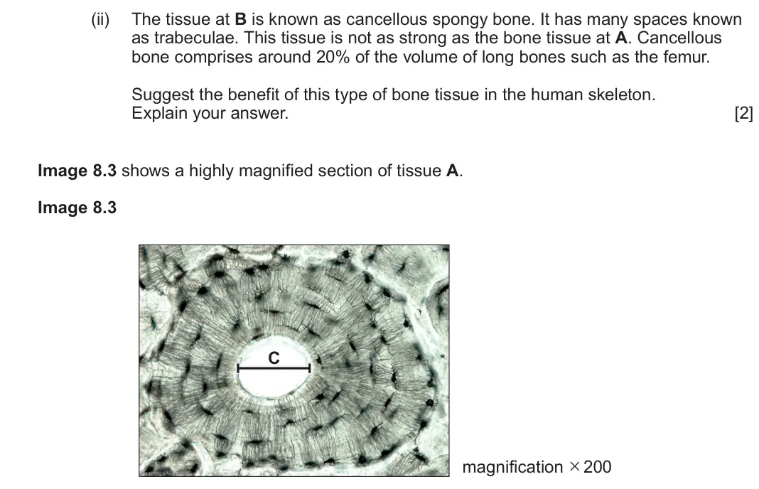 June 2024 Component 3, question 8(b)(ii): The tissue at B is known as cancellous spongy bone. It has many spaces known as trabeculae. This tissue is not as strong as the bone tissue at A. Cancellous bon