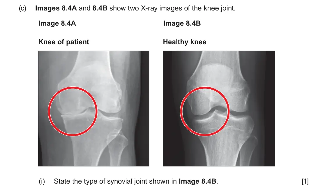 June 2024 Component 3, question 8(c)(i): State the type of synovial joint shown in Image 8.4B. [1]