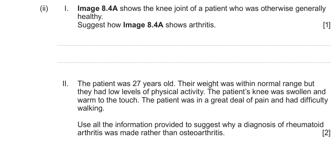 June 2024 Component 3, question 8(c)(ii): I. Image 8.4A shows the knee joint of a patient who was otherwise generally healthy. Suggest how Image 8.4A shows arthritis. [1] II. The patient was 27 years ol