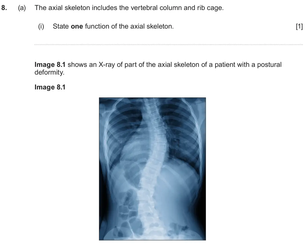 June 2025 Component 3, question 8(a)(i): State one function of the axial skeleton. [1] Image 8.1 shows an X-ray of part of the axial skeleton of a patient with a postural deformity. Image 8.1