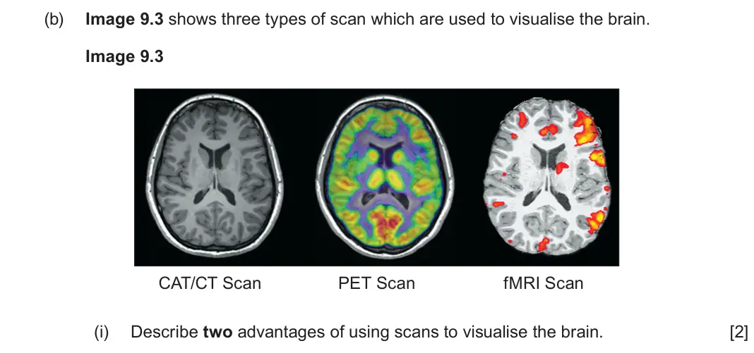 June 2025 Component 3, question 9(b)(i): Describe two advantages of using scans to visualise the brain. [2]
