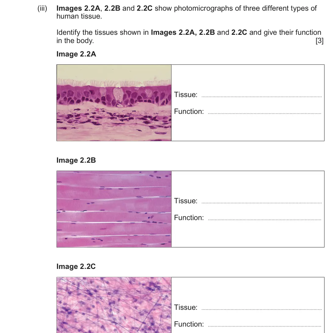 June 2024 AS Component 1, question 2(b)(iii): Images 2.2A, 2.2B and 2.2C show photomicrographs of three different types of human tissue. Identify the tissues shown in Images 2.2A, 2.2B and 2.2C and give the