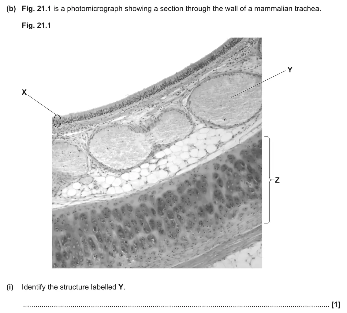 June 2024 AS Paper 1, question 21(b)(i): Identify the structure labelled Y. [1]