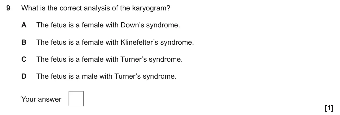 June 2025 AS Paper 1, question 9: What is the correct analysis of the karyogram? A The fetus is a female with Down’s syndrome. B The fetus is a female with Klinefelter’s syndrome. C The fetus is