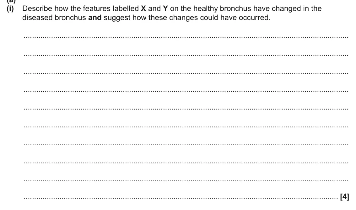 June 2025 AS Paper 1, question 21(a)(i): Describe how the features labelled X and Y on the healthy bronchus have changed in the diseased bronchus and suggest how these changes could have occurred. [4]
