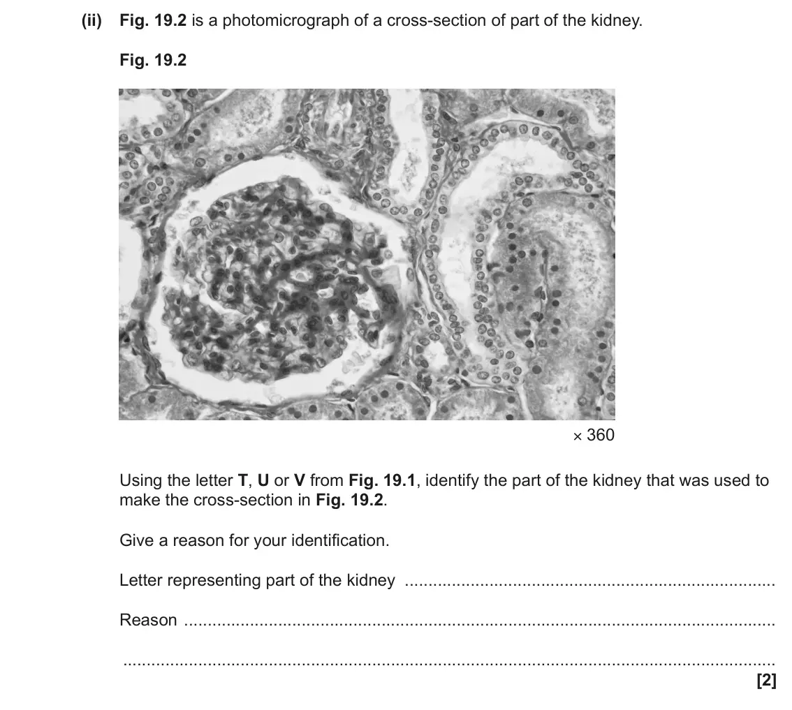 June 2023 Paper 1, question 19(b)(ii): Fig. 19.2 is a photomicrograph of a cross-section of part of the kidney. Fig. 19.2 × 360 Using the letter T, U or V from Fig. 19.1, identify the part of the kid