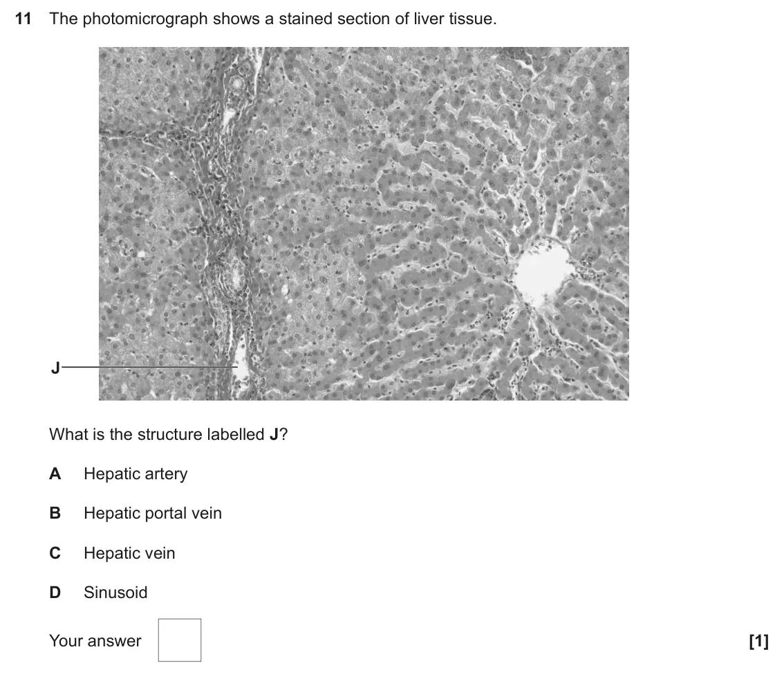 June 2024 Paper 1, question 11: The photomicrograph shows a stained section of liver tissue. J What is the structure labelled J? A Hepatic artery B Hepatic portal vein C Hepatic vein D Sinusoi